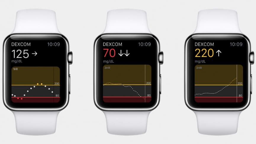 Apple Watch Series 7 guide: Seven rumors analyzed by our team