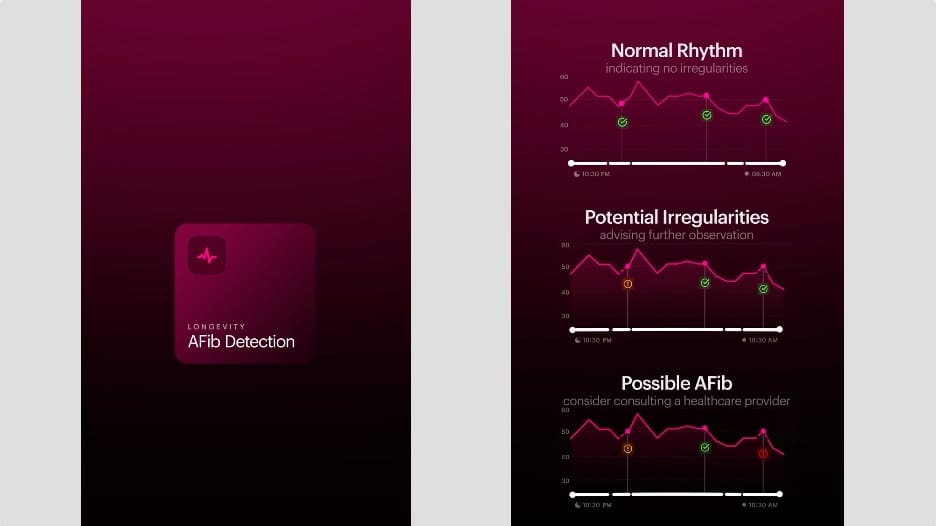 Ultrahuman Afib