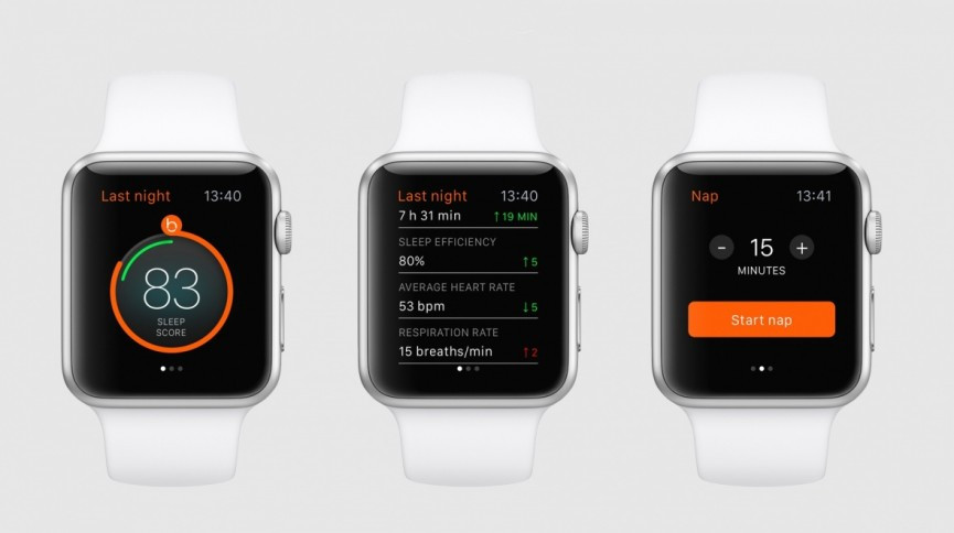 5 ways the Apple Watch can become a better Fitbit rival