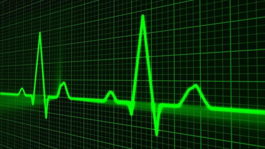 Apple Watch and KardiaBand: Inside AliveCor's massive hyperkalemia study