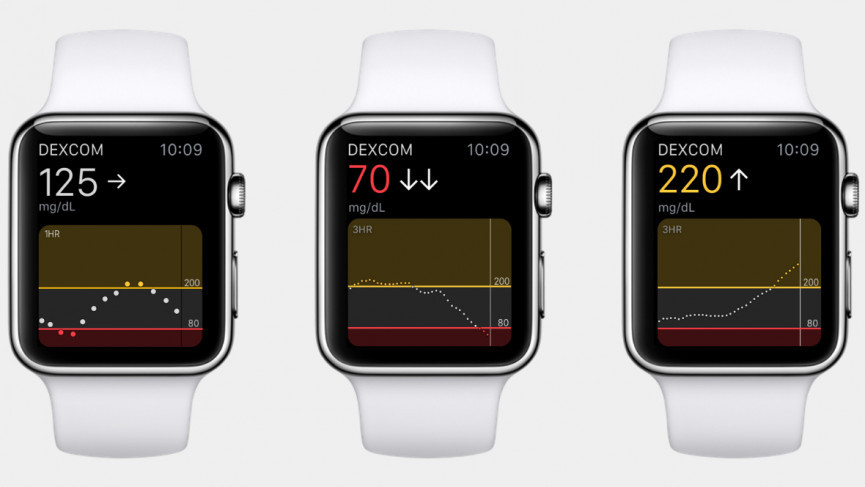 Apple Watch blood pressure is one step closer to reality