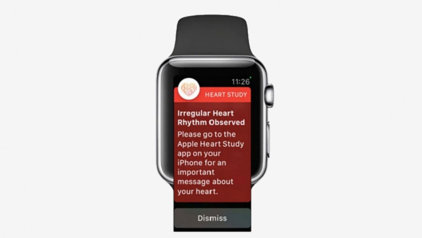 Apple and Stanford's atrial fibrillation study is the largest ever for AFib