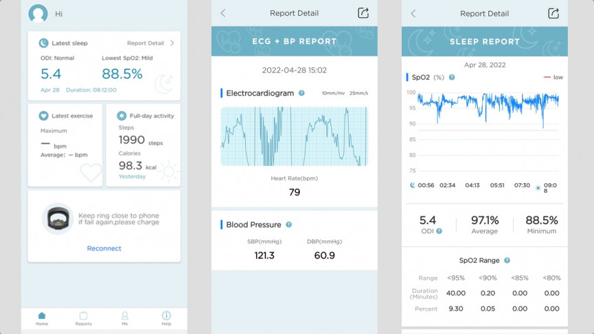 Oura Ring 3 v Circul+: Battle of the smart rings