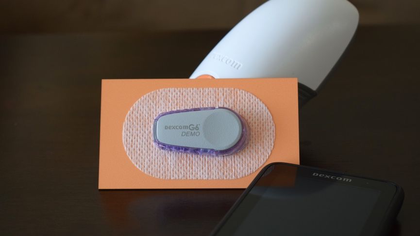With its latest diabetes tech, Dexcom is ready to build the future with Verily