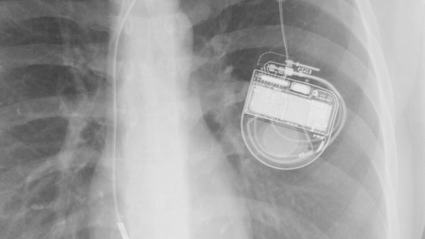 dicom-frame-0-1419256742-RHWL-column-width-inline