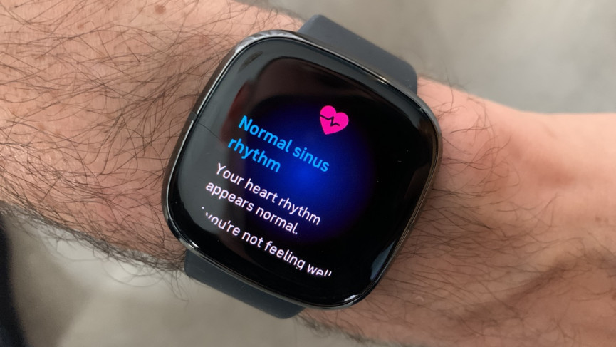 Why ​Fitbit Sense ECG is your essential health tool for 2021