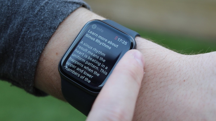 Apple Watch studies: How the smartwatch is tackling health issues