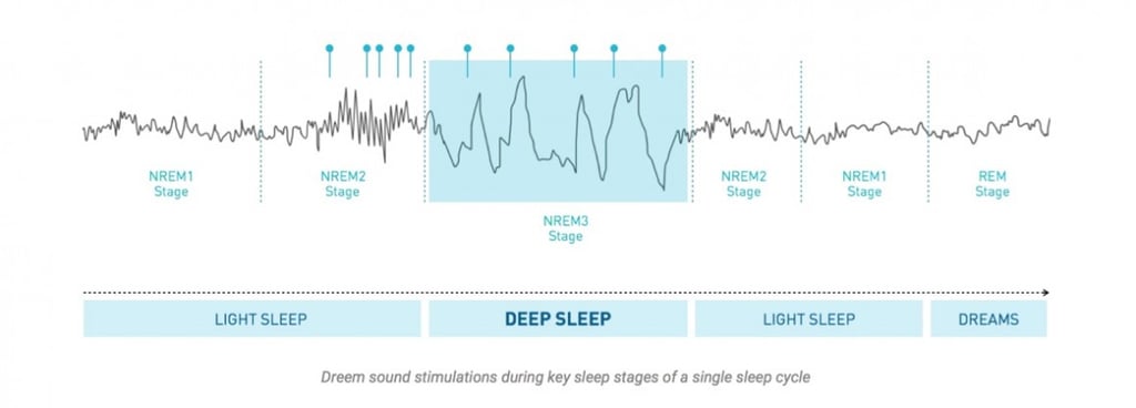 Rythm Dreem headband promises you'll sleep better wearing it