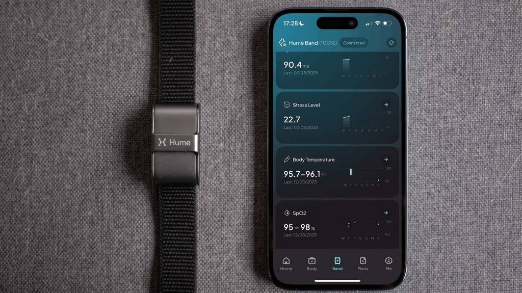 Withings ScanWatch Light
