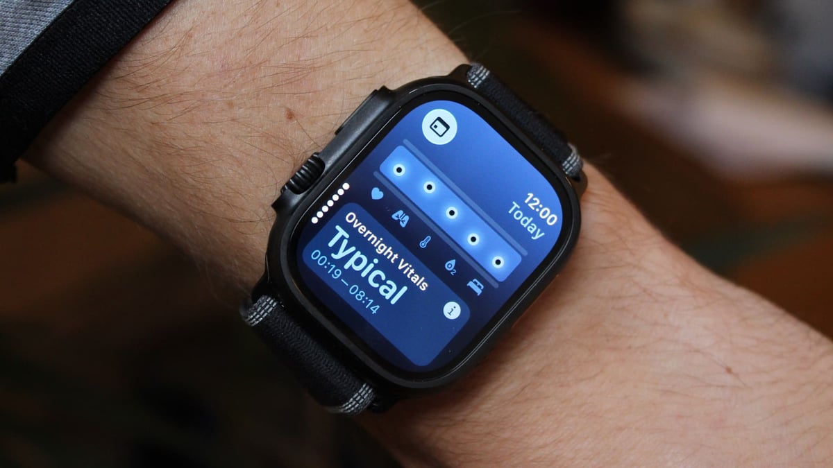 apple-watch-vitals
