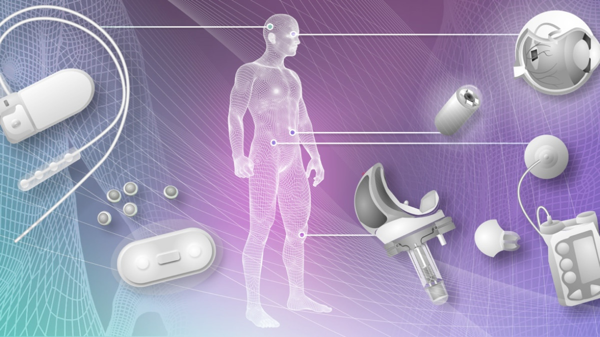 Implantables: Would you go that far?