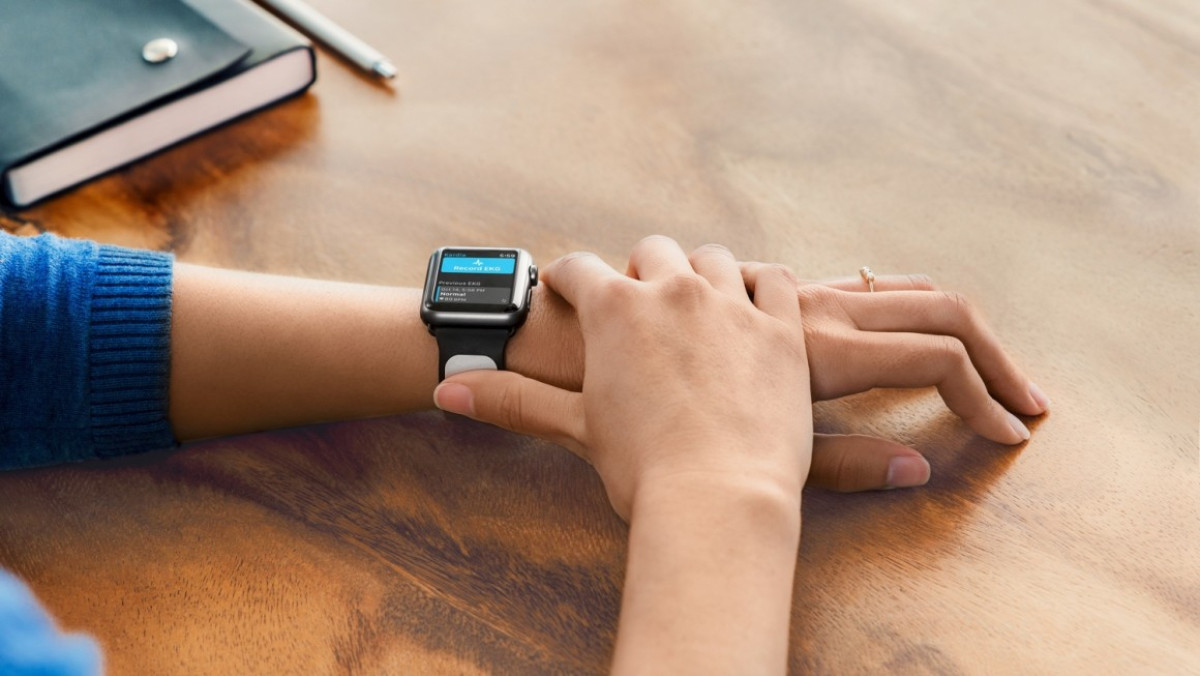 Why Apple Watch smart straps could still be awesome