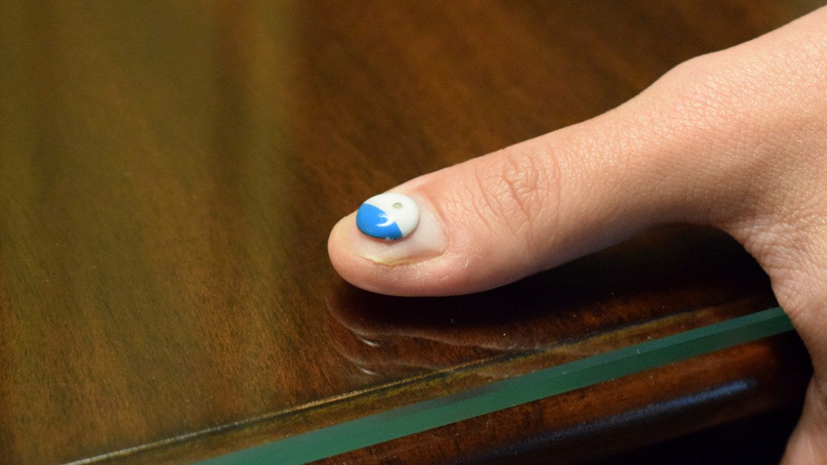 L'Oreal's tiny UV sensor is a smart way to get you to buy more sunscreen