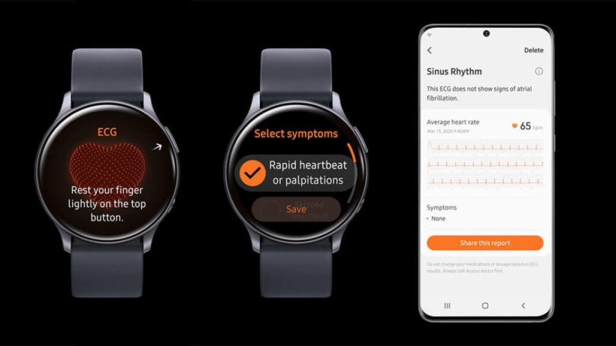 Samsung smartwatches get clearance for ECG – but you will still have to wait
