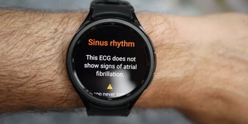 Samsung Galaxy Watch 7 could continuously scan for heart conditions