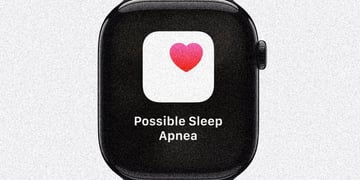 Sleep apnea Apple Watch