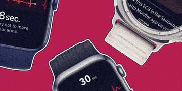 best-ecg-watches