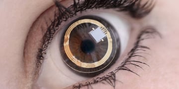 Triggerfish smart contact lens all set to tackle glaucoma