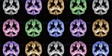 An Oculus exec wants to build affordable, wearable MRI machines