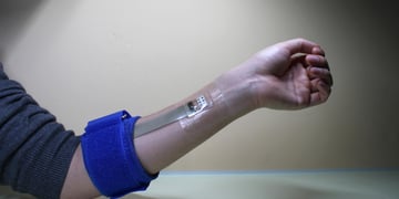 How wearable tech is bringing normality to the lives of diabetics