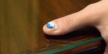 L'Oreal's tiny UV sensor is a smart way to get you to buy more sunscreen