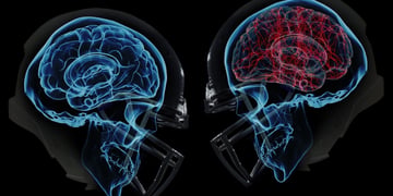 Both on and off the field, wearables are taking on the NFL's concussion crisis
