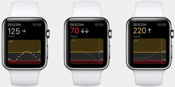 Apple Watch vs diabetes: The glucose monitoring story so far