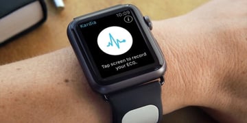 AliveCor receives approval for tracking hyperkalemia through ECG