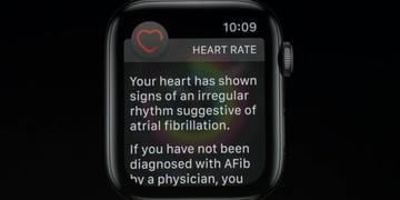 Apple Watch Series 4 ECG feature could take years to be approved in the UK