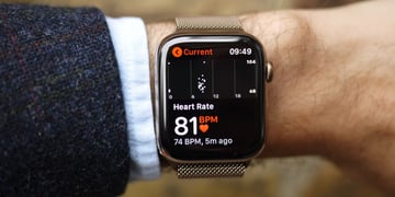 Apple Watch to be used in major study of joint replacement patients