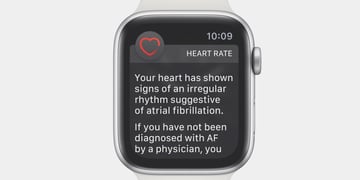 Apple Watch ECG app brings atrial fibrillation detection to the UK