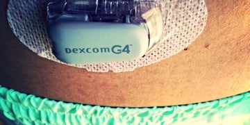 Google on board for next-gen glucose monitoring for diabetics