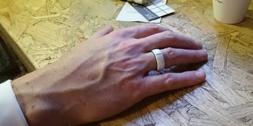 Kerv NFC smart ring wants to free you from the shackles of contactless payments