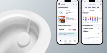 New Withings U-Scan analyzes your pee