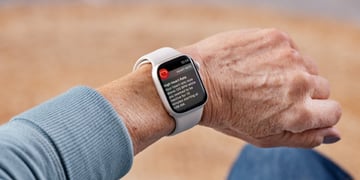 Apple Watch ECG feature to help researchers study children's cancer therapies