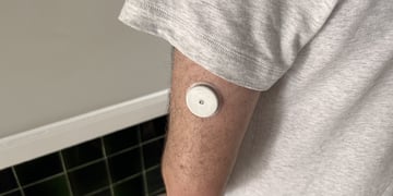 I wore a CGM for 2 weeks – this is what I learned about wearable glucose tracking