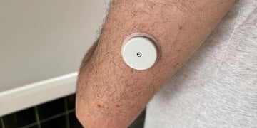 Nutrisense review: We trial the glucose tracking service