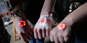 You can now watch grinders implant LEDs into their hands